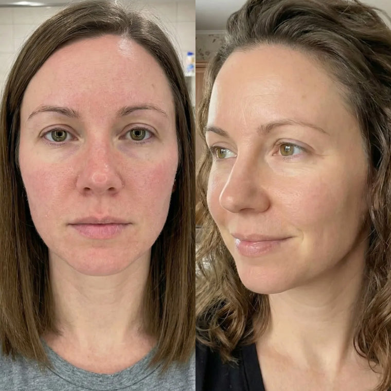 Danielle before and after