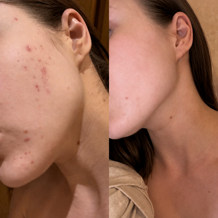 Megan before and after